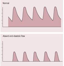 B9780702034893000253/f08-09-9780702034893.jpg is missing