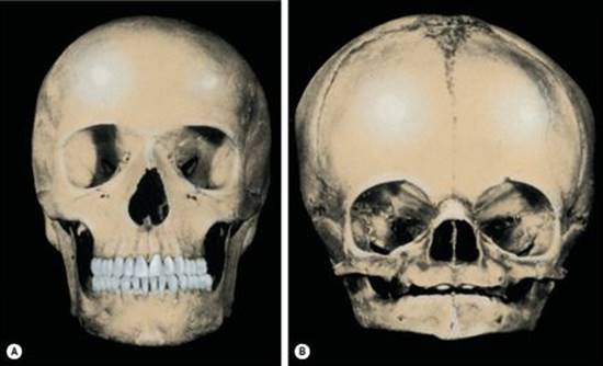 B9780702033957000018/f01-28-9780702033957.jpg is missing