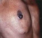 B978070203395700002X/f02-20-9780702033957.jpg is missing