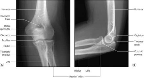 B978070203395700002X/f02-23-9780702033957.jpg is missing