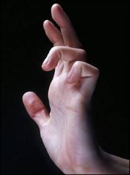 B978070203395700002X/f02-50-9780702033957.jpg is missing