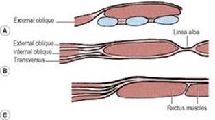 B9780702033957000055/f05-06ac-9780702033957.jpg is missing