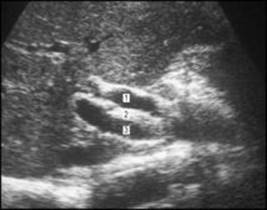 B9780702033957000055/f05-36-9780702033957.jpg is missing