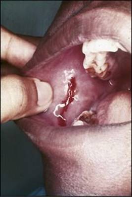 B9780702033957000067/f06-17-9780702033957.jpg is missing