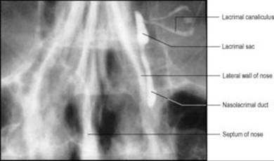 B9780702033957000067/f06-52-9780702033957.jpg is missing