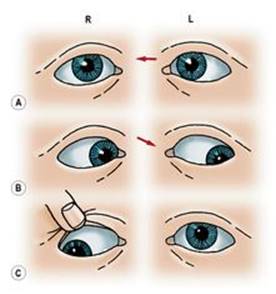 B9780702033957000067/f06-58-9780702033957.jpg is missing