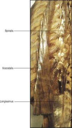 B9780702033957000067/f06-83-9780702033957.jpg is missing