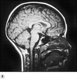 B9780702033957000079/f07-03b-9780702033957.jpg is missing