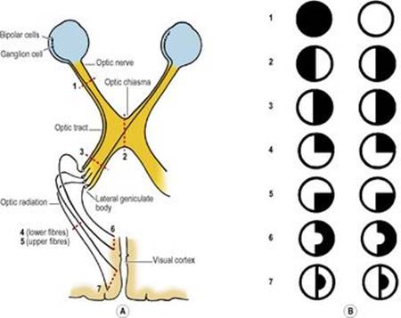 B9780702033957000079/f07-09-9780702033957.jpg is missing
