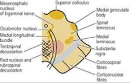 B9780702033957000079/f07-21-9780702033957.jpg is missing