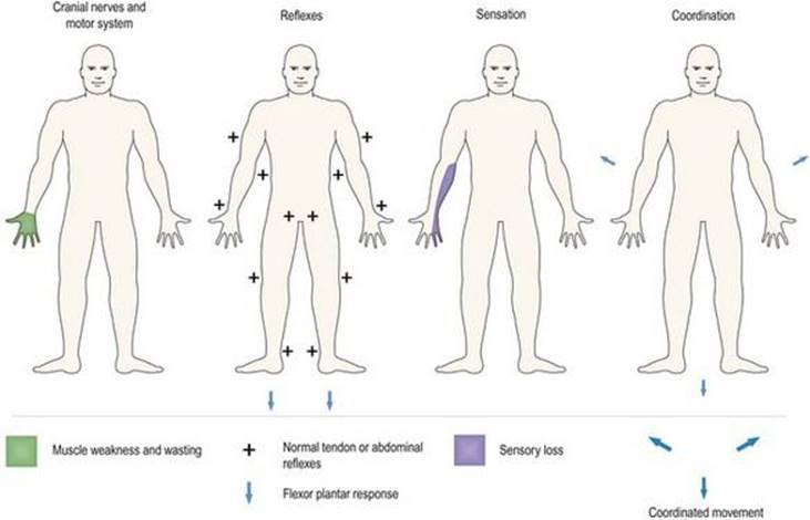 Inverted Reflex Problem-solving - Neuroanatomy An Illustrated Colour Text, 4 ed.