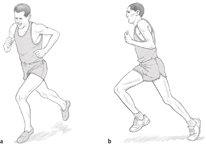 Figure 1.1 Comparing the physical build of (a) a runner from the past with (b) a contemporary runner.