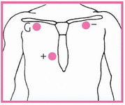 c3-mmu26