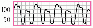 c3-mmu30