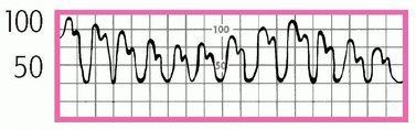 c3-mmu32