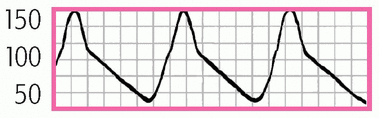 c3-mmu33