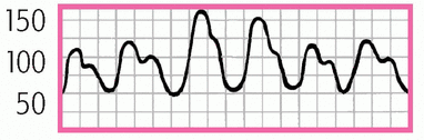 c3-mmu34