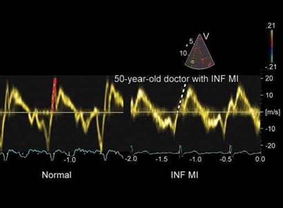 Echocardiographic Assessment of Right Ventricular Function: Methods and ...
