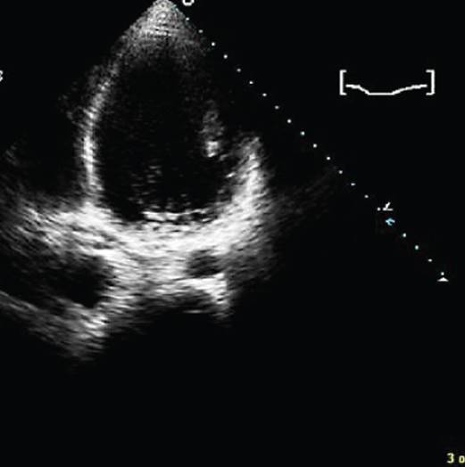 c16f018