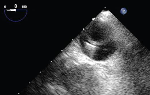 c22f018