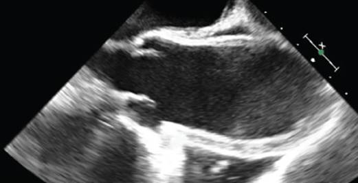 c23f017