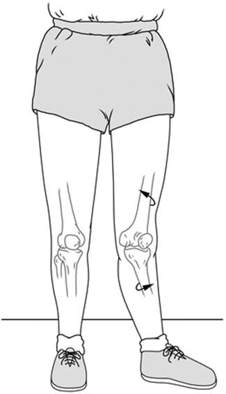 A145875_2_En_15_Fig1_HTML.gif