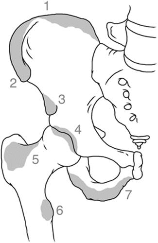 A145875_2_En_15_Fig2_HTML.gif
