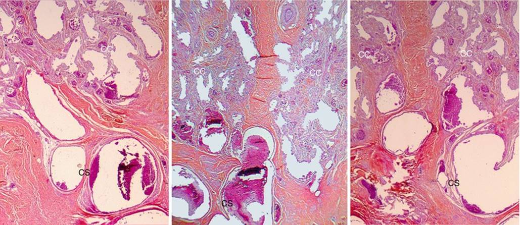 Microscopic Study of the Bulbo-clitoral Organ - Anatomic Study of the ...