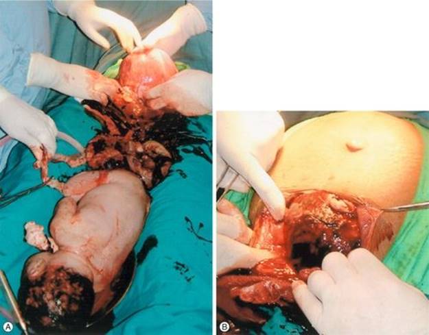 f29-04-9780702054082