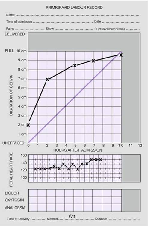 f44-03-9780702054082
