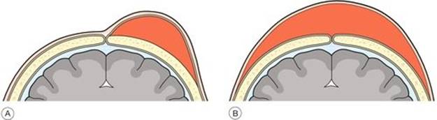 f50-03-9780702054082
