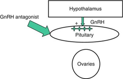 GnRH Antagonist in Ovarian Stimulation - Principles and Practice of ...