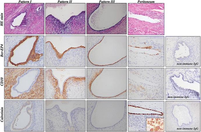 A313895_1_En_3_Fig3_HTML.gif