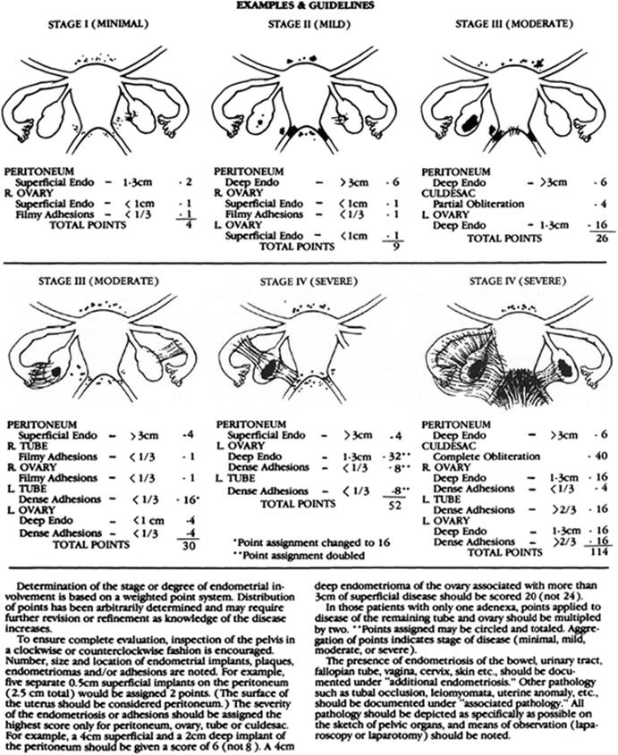 A313895_1_En_21_Fig1b_HTML.gif