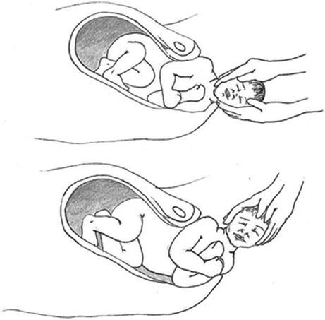 A337409_1_En_12_Fig2_HTML.gif