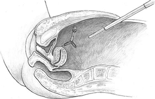 A337409_1_En_16_Fig1_HTML.gif