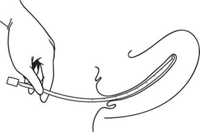 A328473_1_En_4_Fig5_HTML.gif