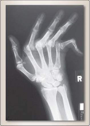 fig_18_3.jpg