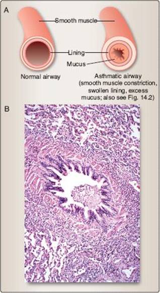 fig_18_4.jpg