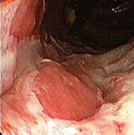 fig_18_5.jpg