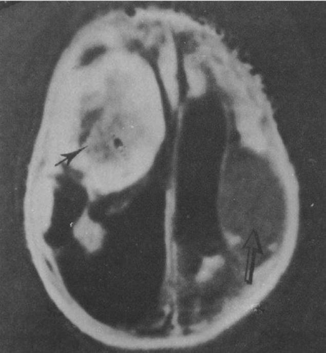 c32f002