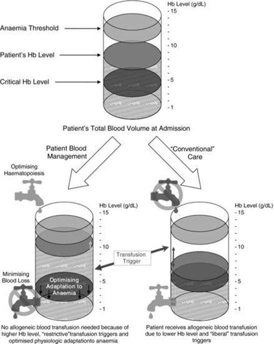 Principles of patient blood management - Alternatives to Transfusion ...