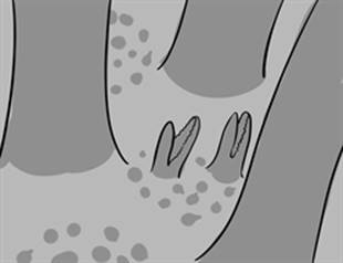pedicellariae.jpg