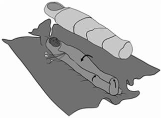 hypothermicPackage (2_).jpg