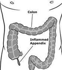 appendix1.jpg