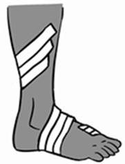 Anklewrap (2).jpg