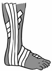 Anklewrap (3).jpg
