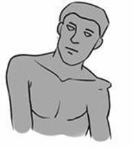 shoulderreduction (1).jpg