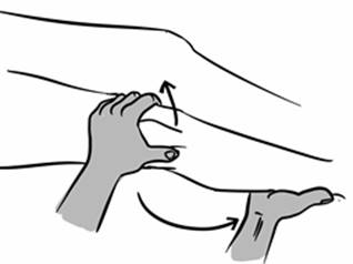 patellreduction2.jpg