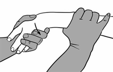 wristreduction2.jpg